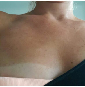 spraytanning 2